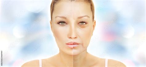 Ageing skin ,internal and external causes of skin aging, signs of skin aging Stock Photo | Adobe ...