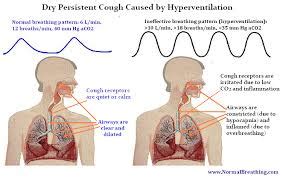 Explain the Causes of a Dry Cough - Assignment Point