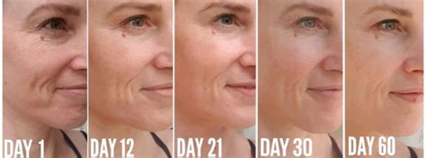 Collagen Before and After Pictures - Do you see the Difference?