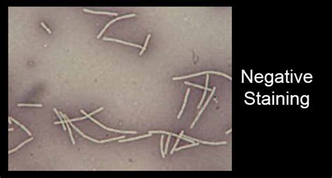 Negative Staining- Principle, Procedure and Result Interpretation