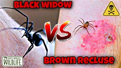 Black Widow Bite