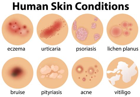 Types Of Skin Conditions