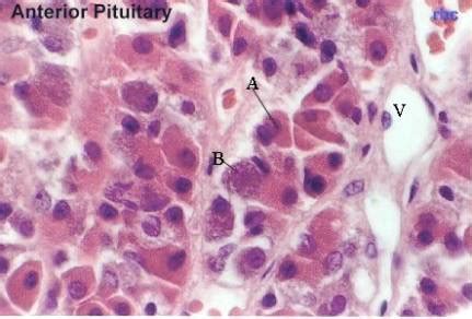 Hypophysis