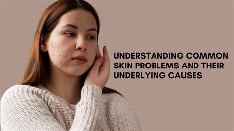 Understanding Common Skin Problems and Their Underlying Causes | by ...