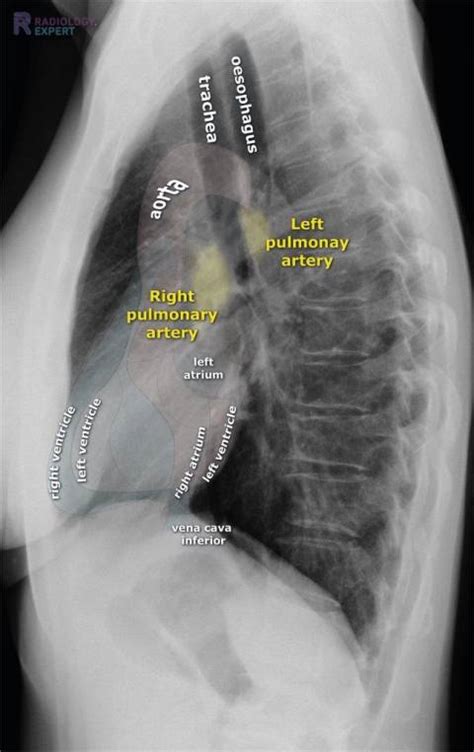 Lateral View Chest Anatomy Esophagus