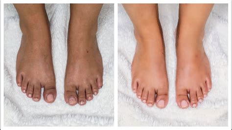 【人気ダウンロード！】 pedicure 272721-Pedicure meaning