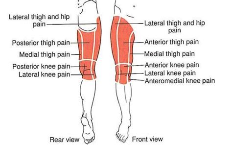 Hip Bursitis | Colorado Pain - Denver, Golden, Lakewood