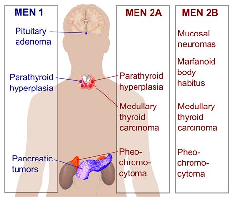 File:Multiple endocrine neoplasia.png - Wikimedia Commons