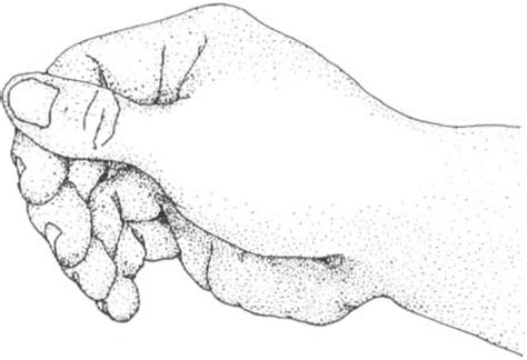 Tenodesis Grasp: (A) Pulp to pulp pinch. (B) Lateral pinch. | Download Scientific Diagram