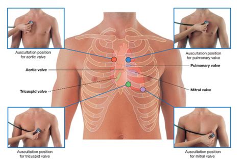 Auscultation landmarks, cardiac sounds, electrical pathway Flashcards ...