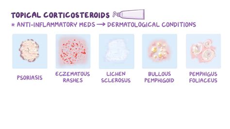 Corticosteroids