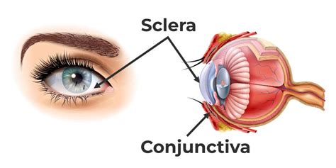 Difference Between Sclera And Conjunctiva - GeeksforGeeks