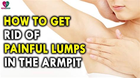 What Causes Armpit Lumps - These cysts and bumps can be painful, small or big. - Download Free ...