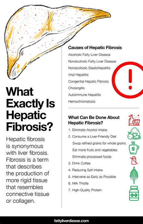 What You Need to Know About Hepatic Fibrosis - Fatty Liver Disease