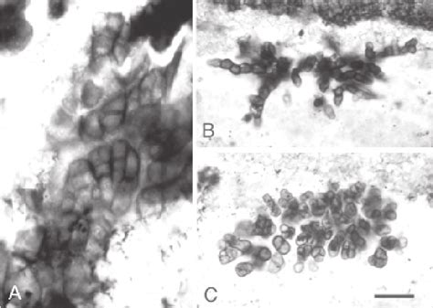 3 Proterozoic fossils interpreted as Group II cyanobacteria. A ...