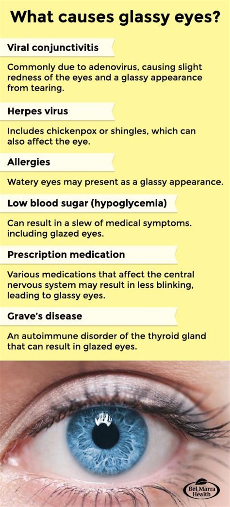 10 Causes of Glassy Eyes: Treatment and Prevention | Alternative health, Glassy eyes, Treatment