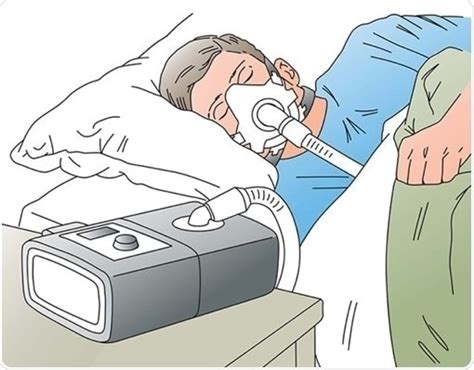 The importance of pressure sensors in PAP machines