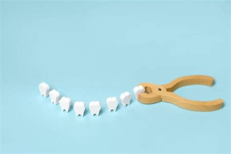 What is Wisdom Tooth Extraction? 3 Things You Need to Know