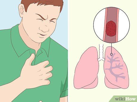 3 Ways to Diagnose Lung Problems - wikiHow Health