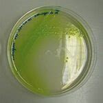 Cetrimide agar: composition, preparation and uses - Best...