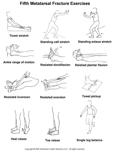 Foot Fracture Fifth Metatarsal Fracture Exercises Illustration Page | Hot Sex Picture