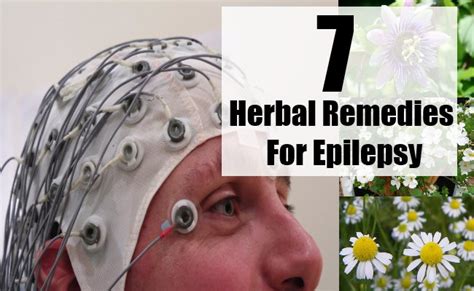 7 Herbal Remedies For Epilepsy | Search Home Remedy