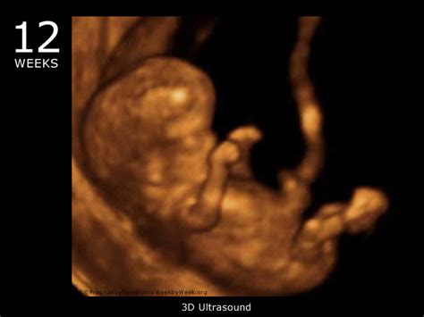 12 Week 3D Ultrasound Baby Picture | Pregnancy Symptoms Week by Week