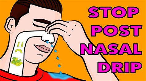 Post-nasal Drip: Symptoms, Causes, Diagnosis, Treatment, 58% OFF