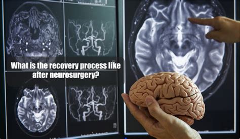 What is the Recovery Process Like After Neurosurgery? | Dr Baker ...