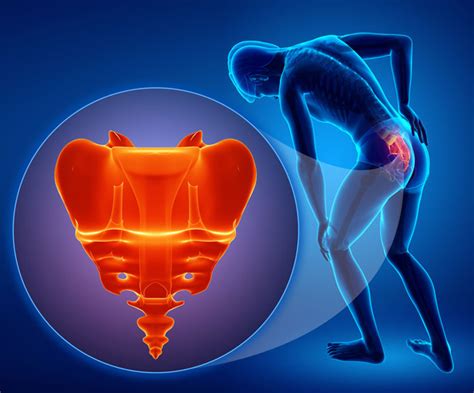 Sacrum and Coccyx Pain Management | Pain Solutions Medical