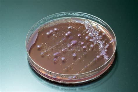 Bacterial Colonies on Agar Medium Petri Dish Plate Plate on MacConkey ...