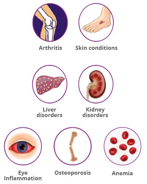 Complications of IBD