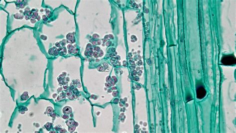 Phloem and its Kinds - Sieve elements, Companion cells, Phloem parenchyma