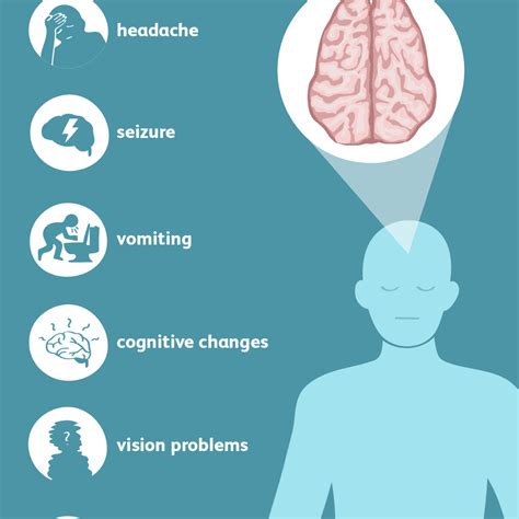 Signs and Symptoms of a Brain Tumor