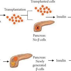 Possible strategies for beta cell replacement and regeneration therapy ...