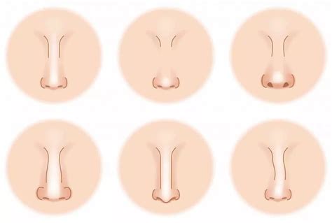 Nose Types Shapes