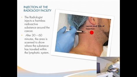 Fine Needle Aspiration Lymph Node Biopsy