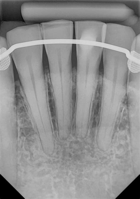 Radiographs | FTGimaging.com