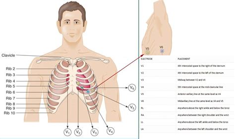 13 Lead Ecg Placement-How To Place The 13th Ecg Lead