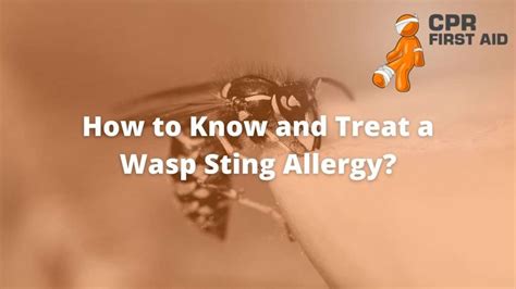 How To Know And Treat A Wasp Sting Allergy? | CPR First Aid