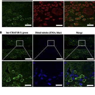 RNAscope FISH and immunofluorescence analysis of renal tissue of IgA... | Download Scientific ...