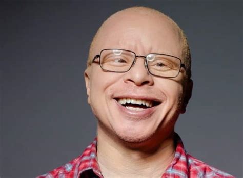 Famous Albino People You Should Know