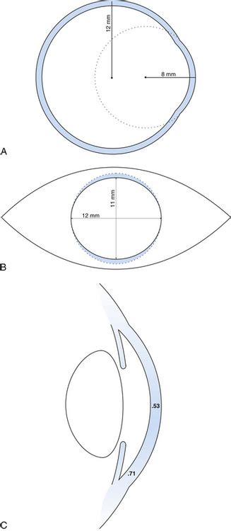 Cornea and Sclera | Basicmedical Key