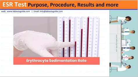 ESR Test Procedure | Lab Tests Guide