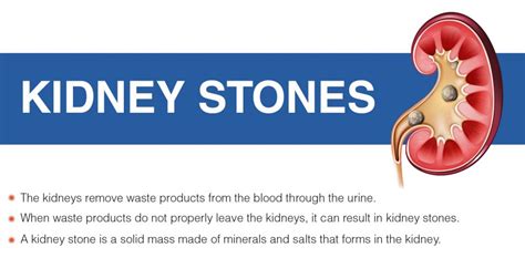 Overview of Kidney Stones - Signs, Symptoms, and Treatment