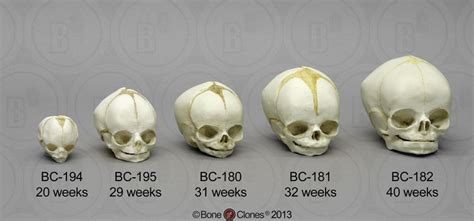 Human Fetal Skull Set of 5 Skulls - Bone Clones, Inc. - Osteological Reproductions | Skull and ...