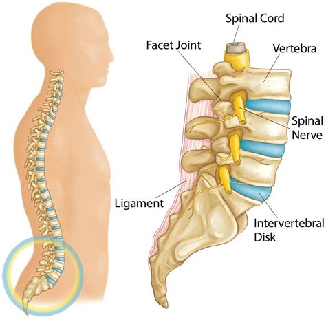 Herniated Disk in the Lower Back - OrthoInfo - AAOS