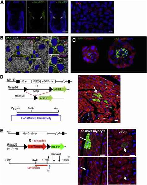 C-KIT+ progenitor cells. A. Representative images showing C-KIT+ cells ...