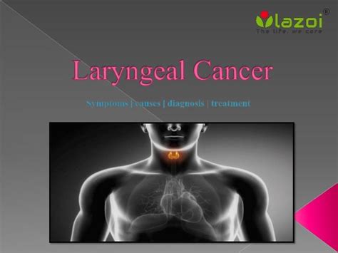 Laryngeal Cancer: Symptoms, causes, diagnosis and treatment.