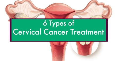 6 Types of Cervical Cancer Treatment | Cervical Cancer Treatment